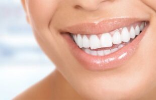 Diş Estetiği Fiyatları 2023, Lamine, Porselen, Zirkonyum Fiyatı img